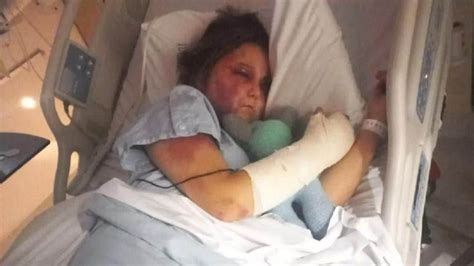 kirra hart news|Kirra Harts story — Her brutal attack explained